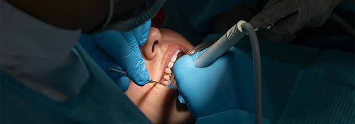 FC – Sedation Dentistry at iSmileBrooklyn in Brooklyn NY